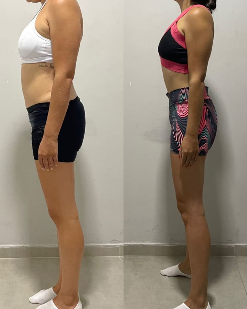 Resultado antes e depois — Método Carolina De Paula