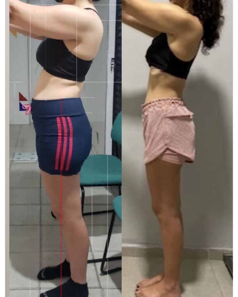 Antes e depois — musculação feminina personalizada