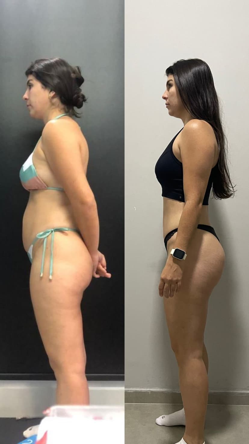 Antes e depois — transformação com o Método Carolina De Paula